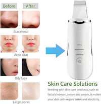 3-in-1 Ultrasonic Facial Scrubber – Deep Cleansing, Blackhead Remover & Skin Lifting Device (Rechargeable)